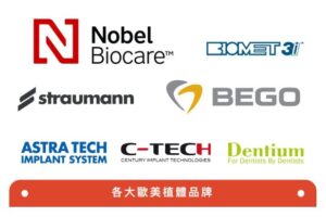 缺牙怎麼辦？新時代靠「黑科技」不再怕植牙失敗