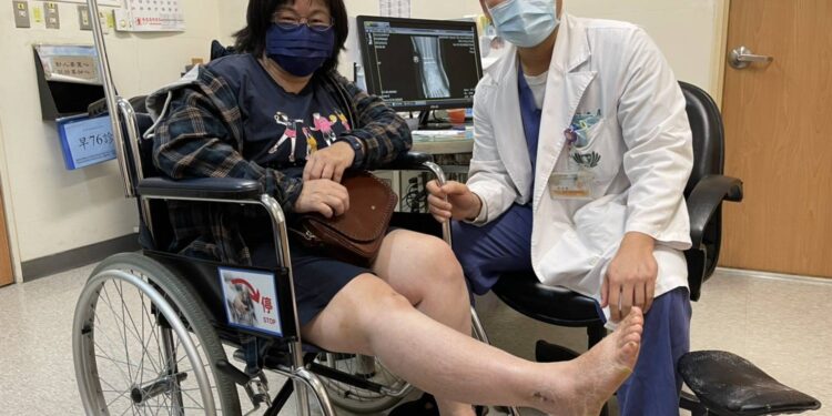腳踝扭傷骨折把握黃金治療期  避免關節炎甚至影響行走