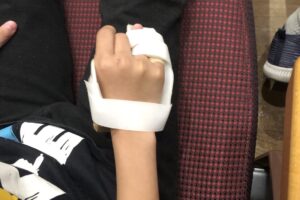 小三女校園跌倒手指嚴重骨折　調查延宕家長質疑校方態度顢頇