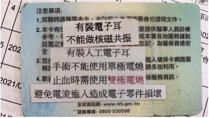 民眾陳情電子耳納入健保卡註記　黃崇真：11月底醫療雲端系統上線將納入