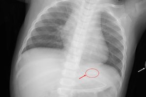 危機暗藏 國際加熱菸傷童案例頻傳 台灣審查機制亟待完善