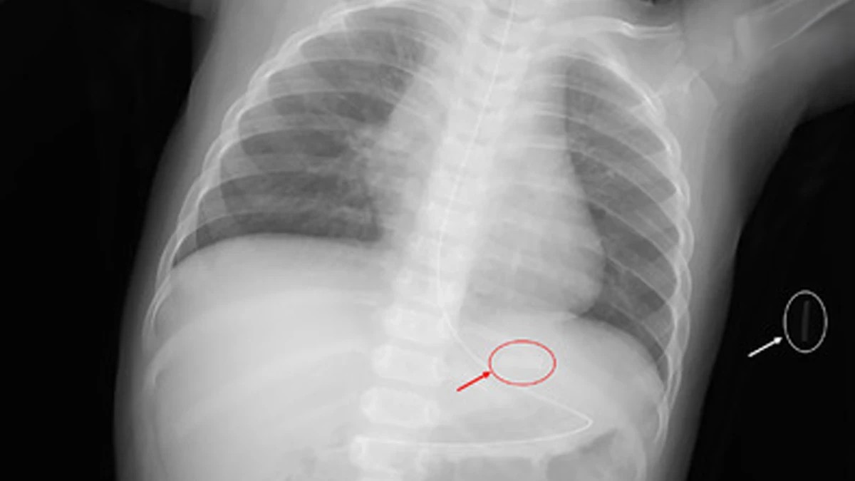 危機暗藏 國際加熱菸傷童案例頻傳 台灣審查機制亟待完善