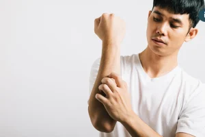 卸下長袖 告別脫皮人生 醫：穩控乾癬避免引發關節炎