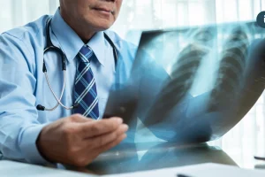 50歲男肺癌連葉克膜都用上！免疫治療+抗血管新生合併化療穩病情