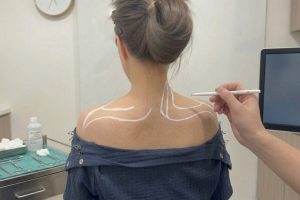 肩頸緊繃影響睡眠品質 謝忠佑醫師解析肌肉放鬆與生活型態關聯